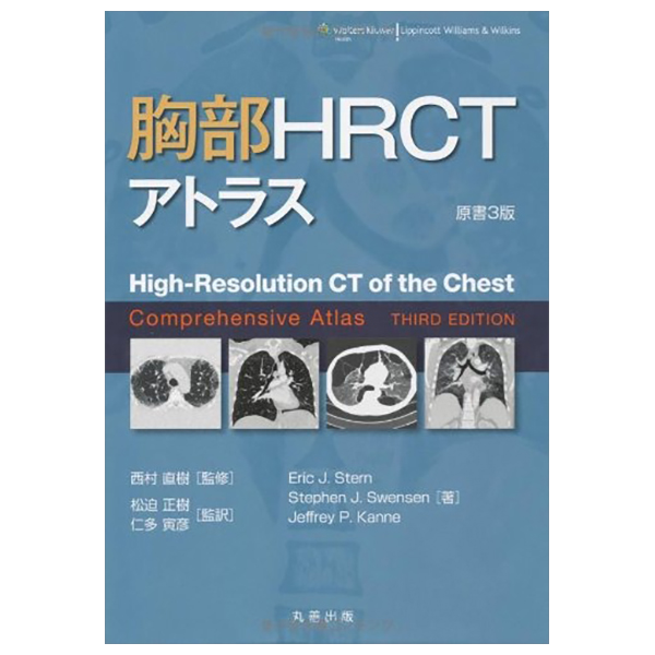 胸部hrctアトラス - high-resolution ct of the chest comprehensive atlas (third edition)